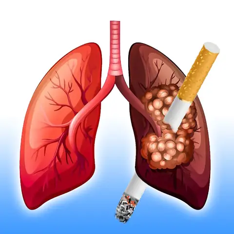 Cách Vẽ Lá Phổi