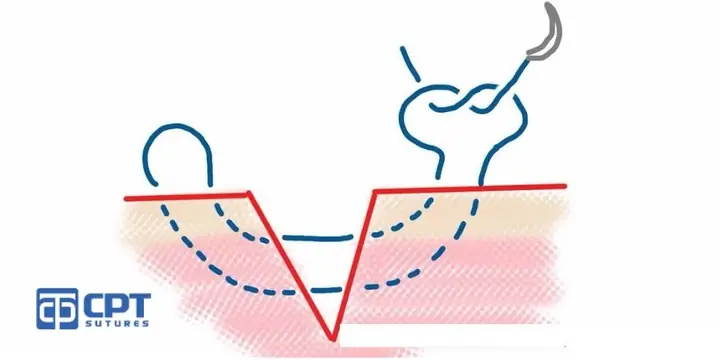 Cách Vẽ Mũi Khâu Cách Vẽ Mũi Khâu