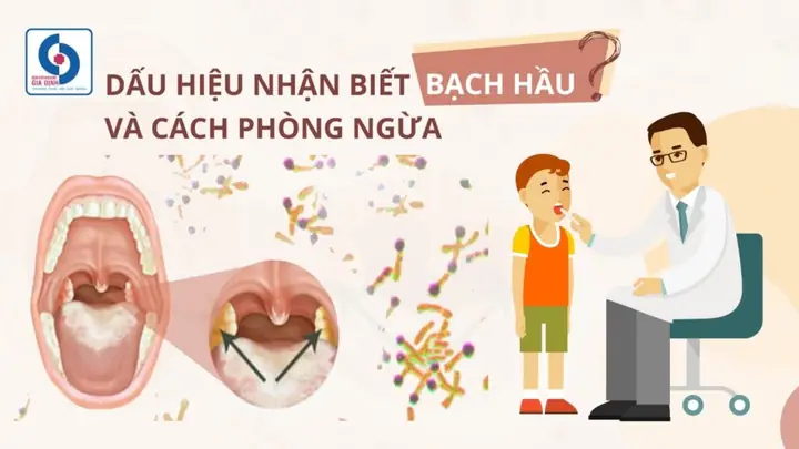 Cách Nhận Biết Dân Vẽ Cách Nhận Biết Dân Vẽ