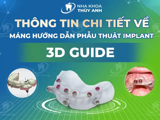 Cách Vẽ 3đ Rạch Tay