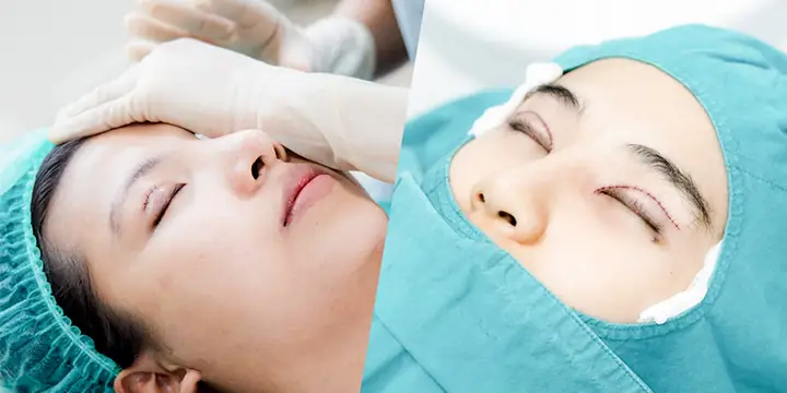 Cách Vẽ Băng Gạc Mắt