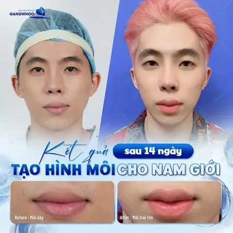 Cách Vẽ Hình Đôu Môi Cách Vẽ Hình Đôu Môi