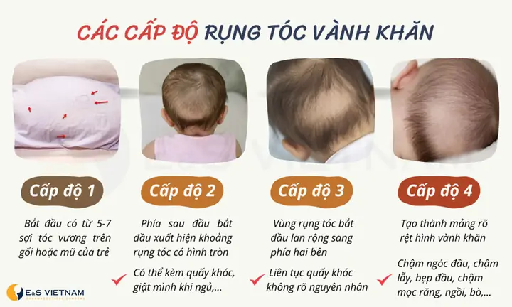 Cách Vẽ Hình Vành Khăn