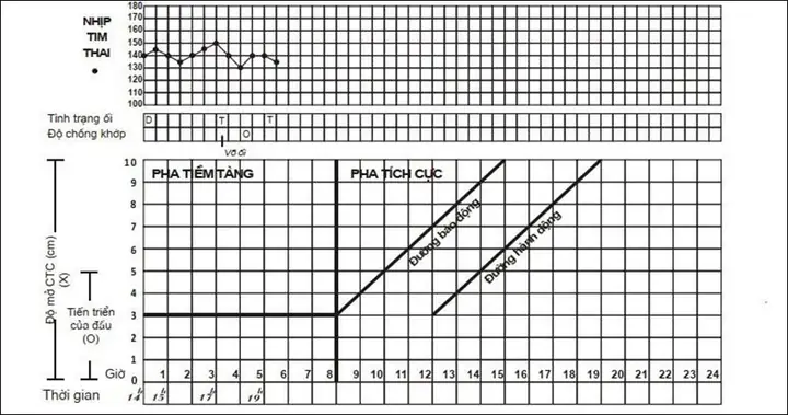 Cách Vẽ Partograph Độ Lọt