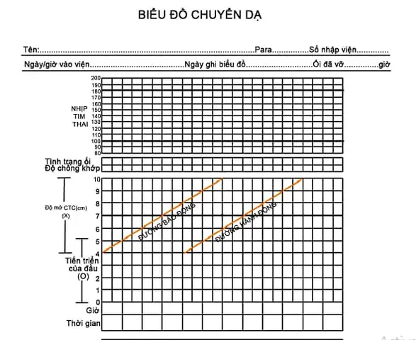 Cách Vẽ Partograph Độ Lọt