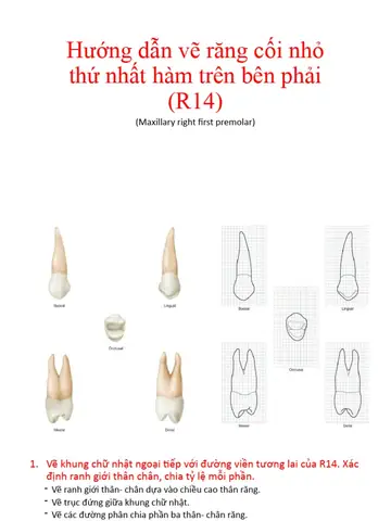 Cách Vẽ Răng Trên Trục Cách Vẽ Răng Trên Trục